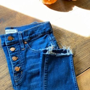 Madewell 10” high rise button front skinny jeans